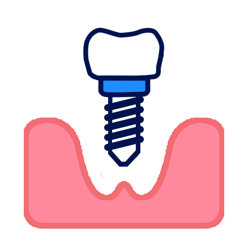 Dental Implant Icon Final