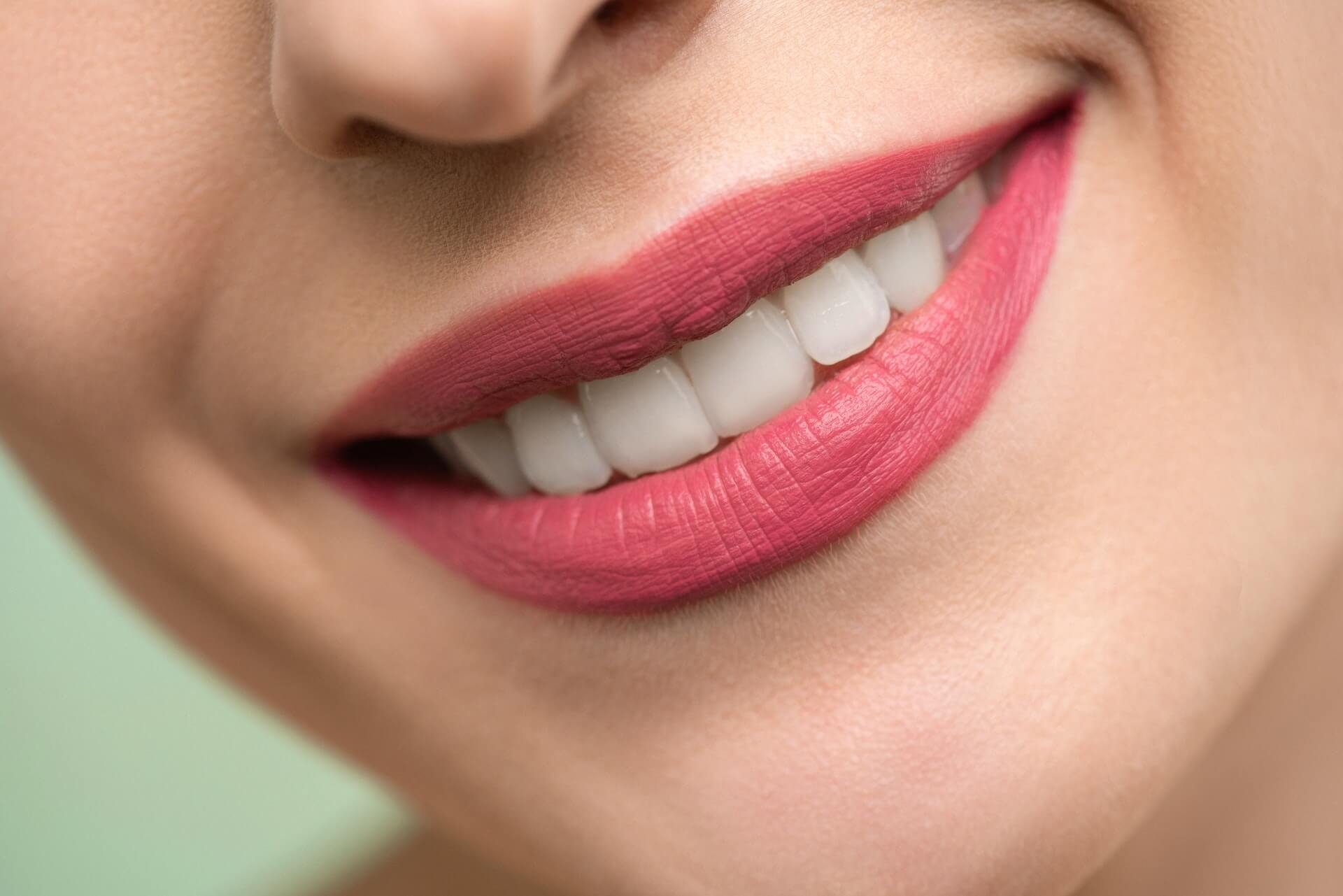 All you need to know about teeth whitening - 5 - Smiles Dental Group