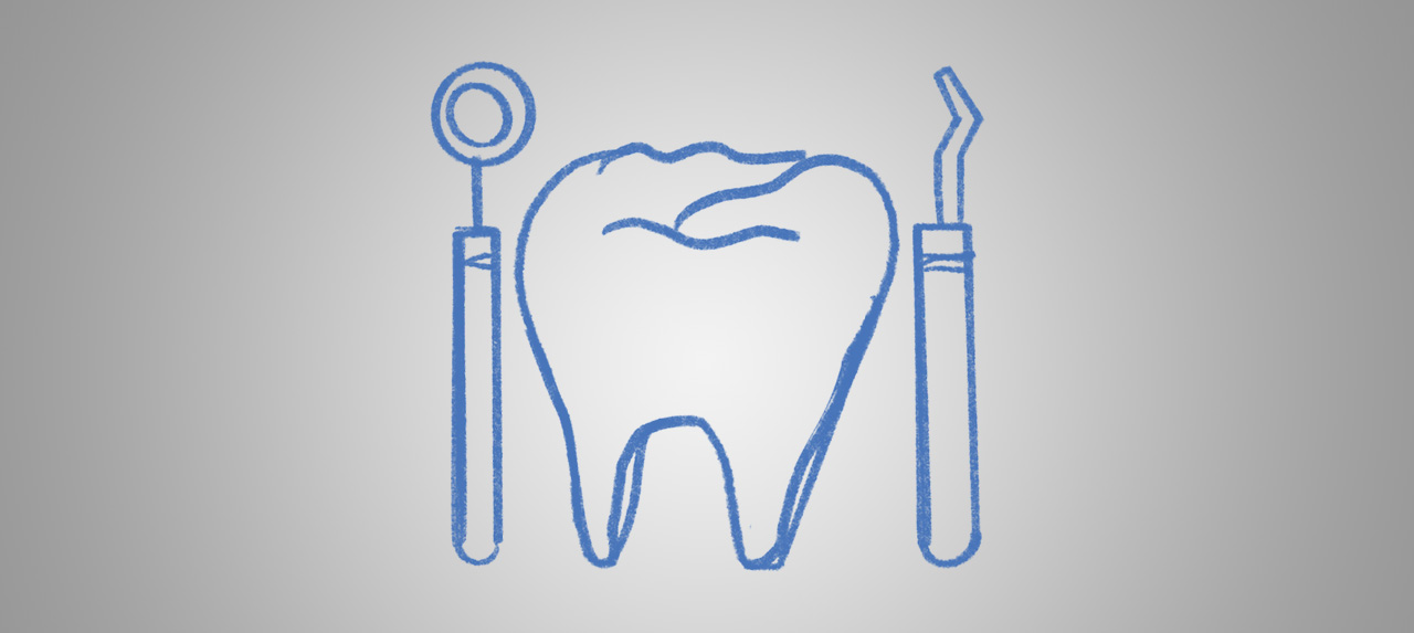 Have A Toothache? Causes, Prevention, Solution - 5 - Smiles Dental Group