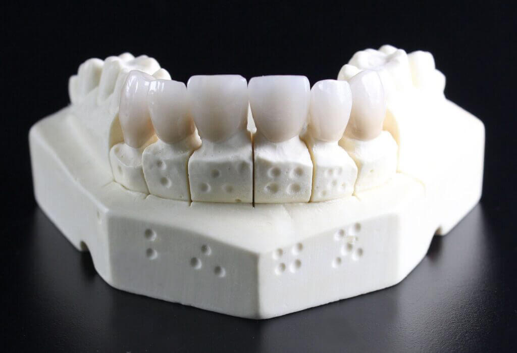 dentures 759929 1920 1 1024x699 1