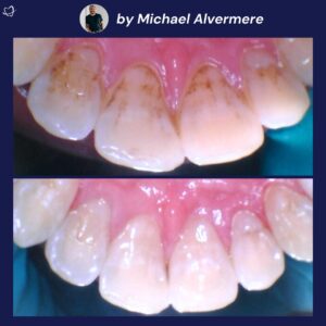 Copy of fillings (37)
