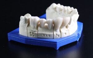 dentures 759928 1280